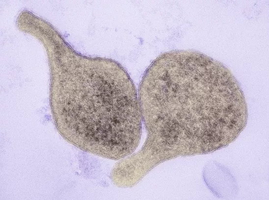Mycoplasma Genitalium Symptoms, Testing & Treatment in Singapore