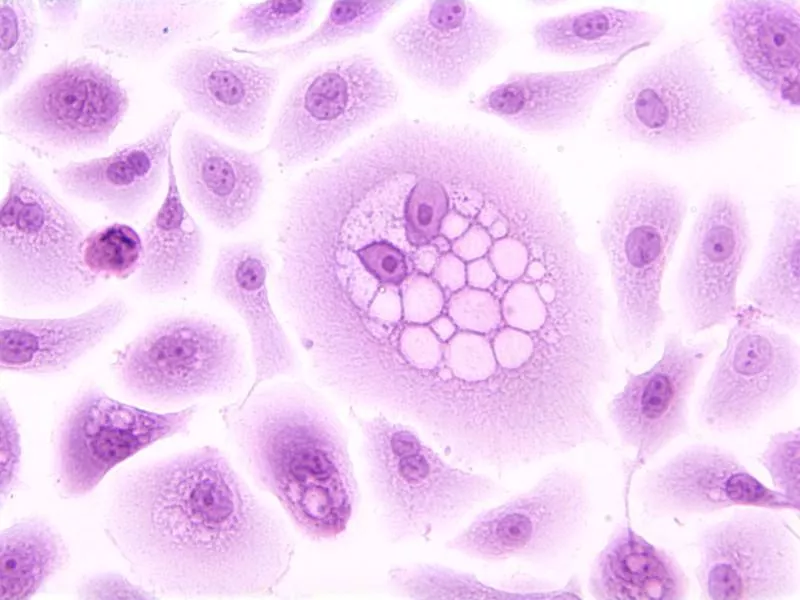 HPV in Males and Females: Symptoms, Risks, Testing, and Prevention